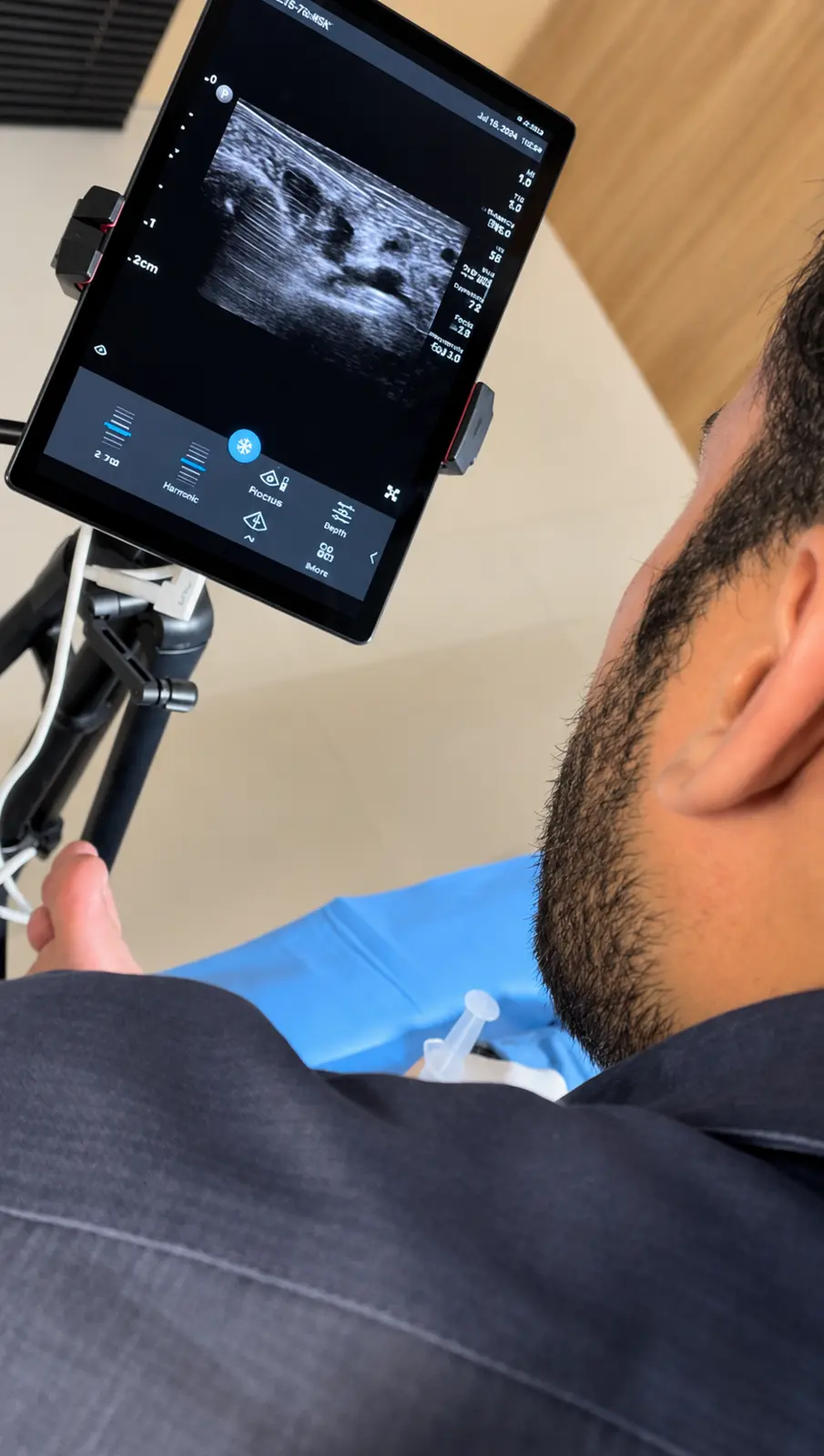 Ultrassom musculoesquelético utilizado para orientação anatômica